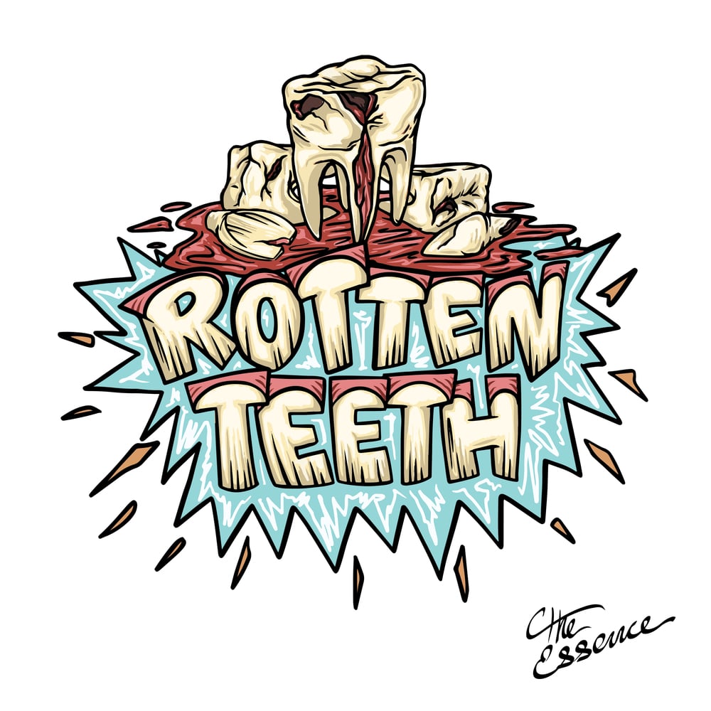 Rotten Teeth
